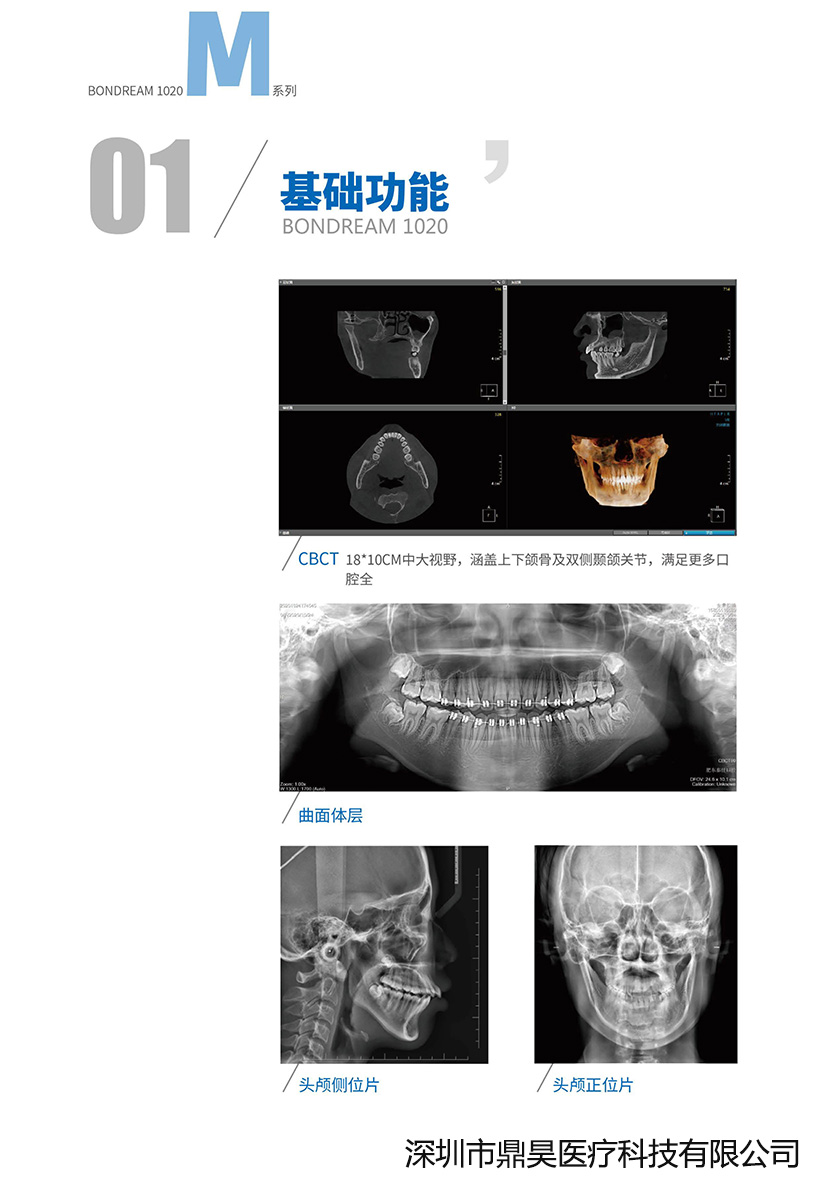 伯爵M CBCT