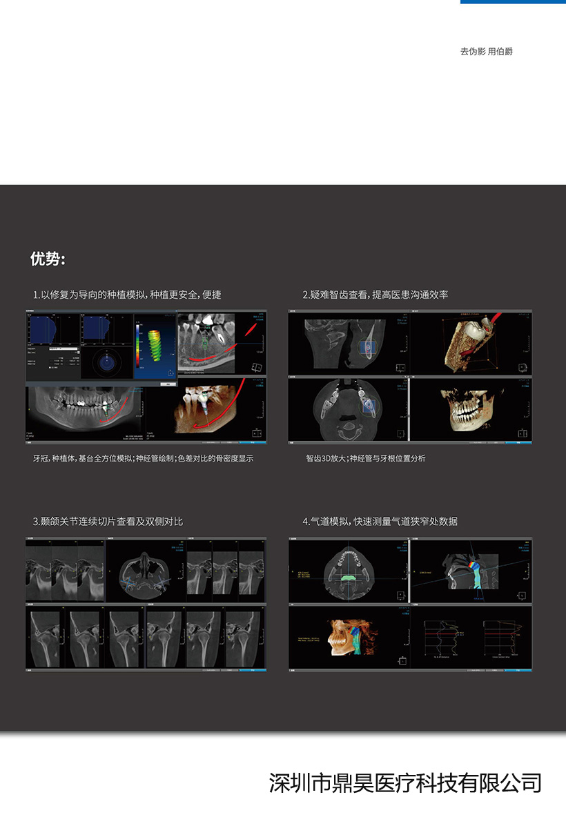 牙科CBCT